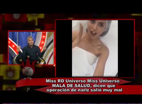 Miss RD Universo MALA De SALUD Dicen Que Operación De Nariz Salio Muy Mal