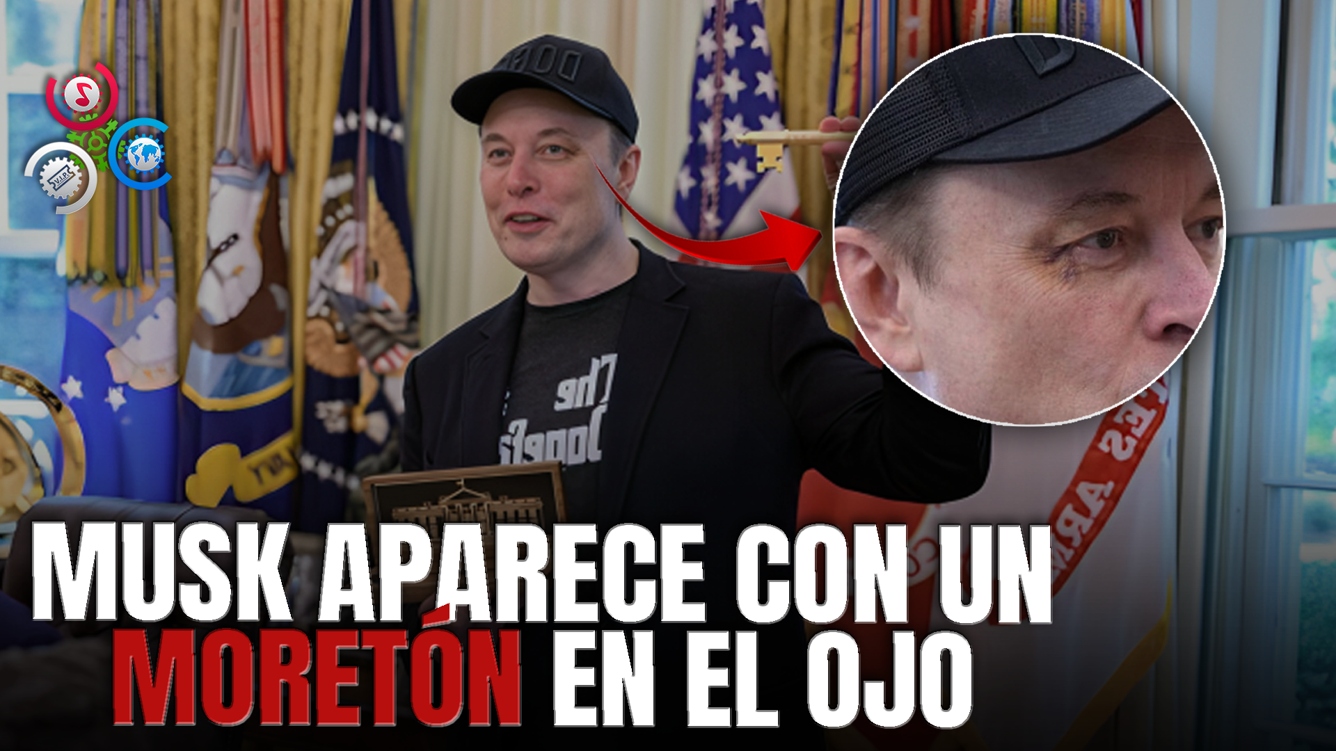 Moretón De Elon Musk Causa Revuelo En Redes Sociales