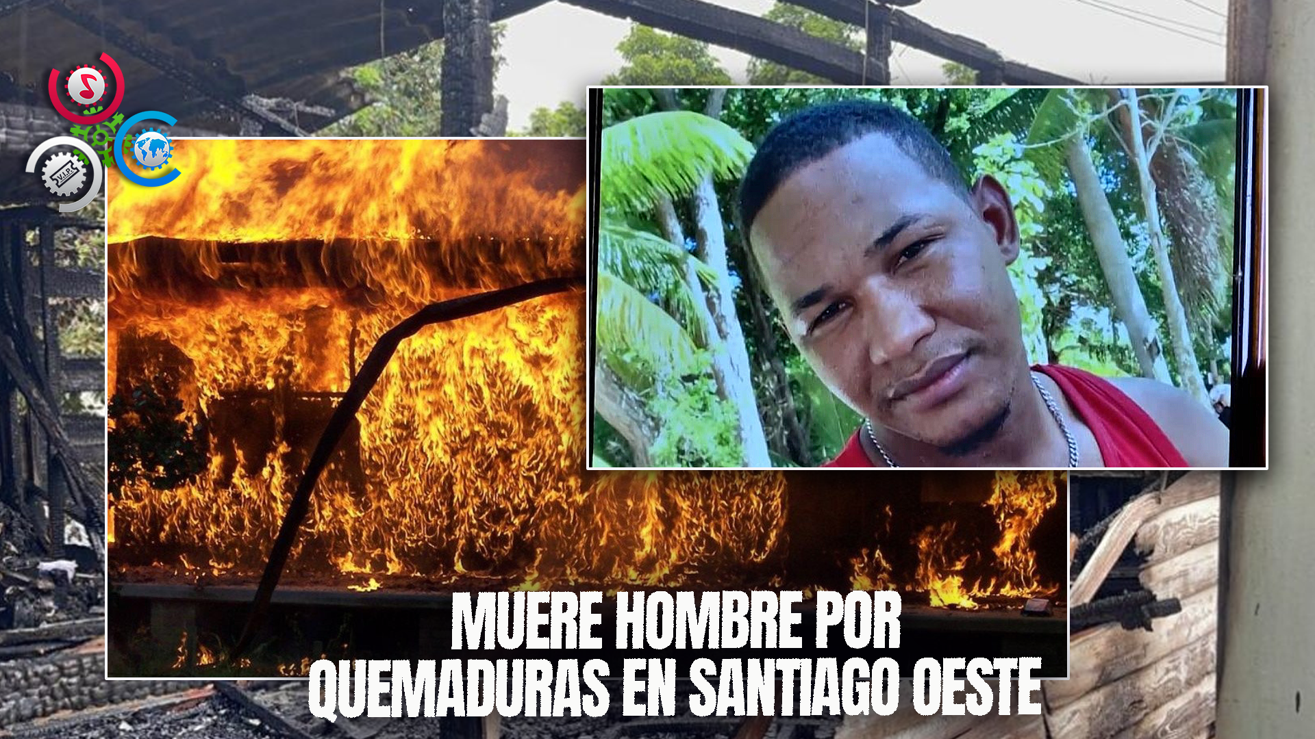 Muere Hombre Que Sufrió Quemaduras En Un Incendio En Santiago Oeste