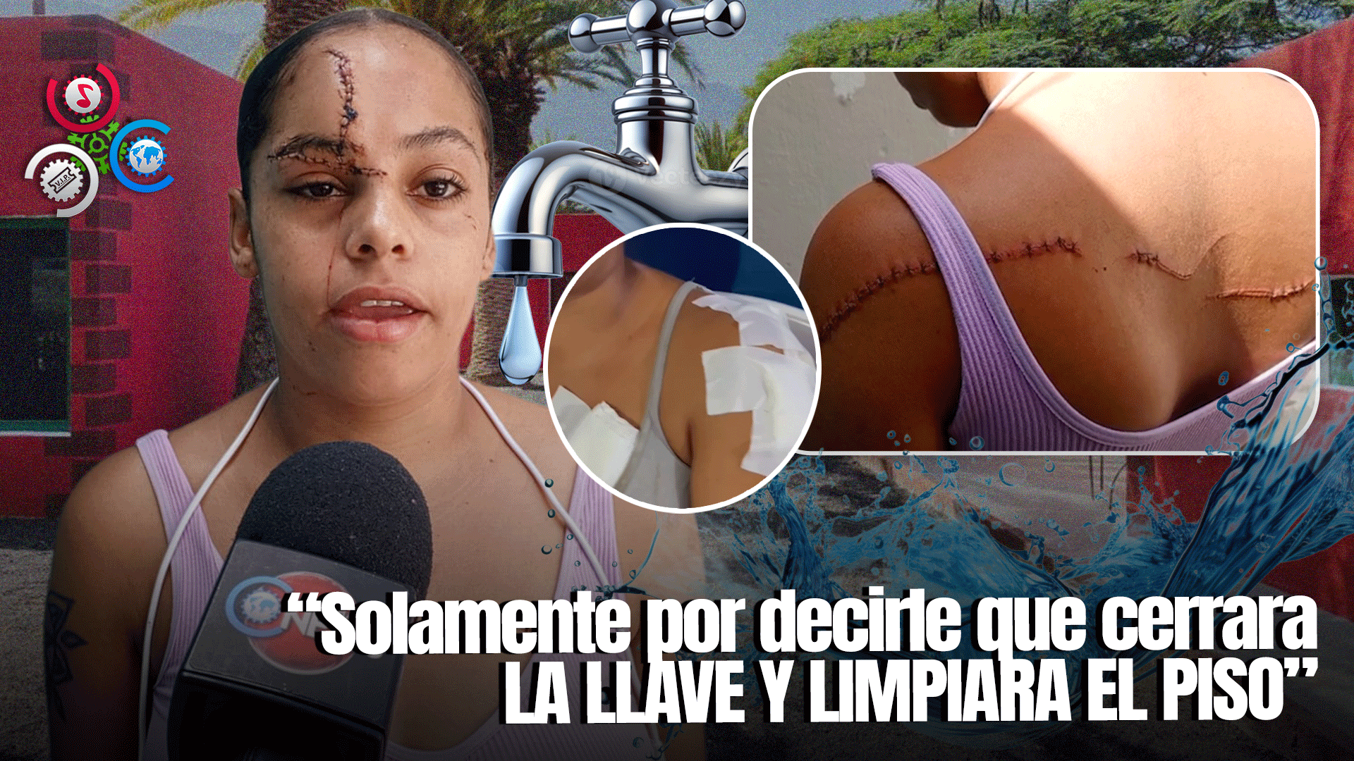 Mujer Agrede A Su Vecina Con Arma Blanca Por Conflicto Con Llave De Agua