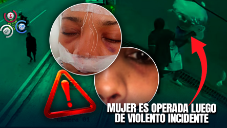 Mujer Denuncia BRUTAL Agresión De Supuesto Indigente En El Kilómetro 9 De La Autopista Duarte