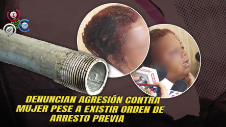 Mujer Denuncia Brutal Agresión De Su Expareja Con Un Tubo En La Ciénaga