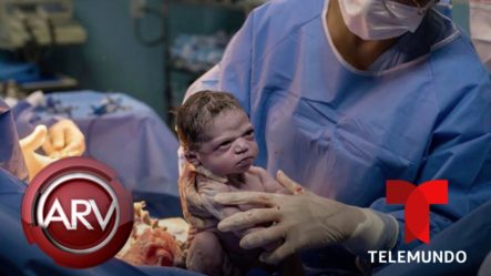 Nace Un Bebé Con Cara De Enojo Sin Llorar Y Su Foto Hizo Estallar Las Redes