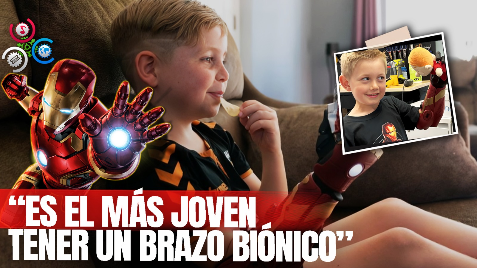 Niño De Nueva York Se Convierte En La Persona Más Joven En Tener Un Brazo Biónico