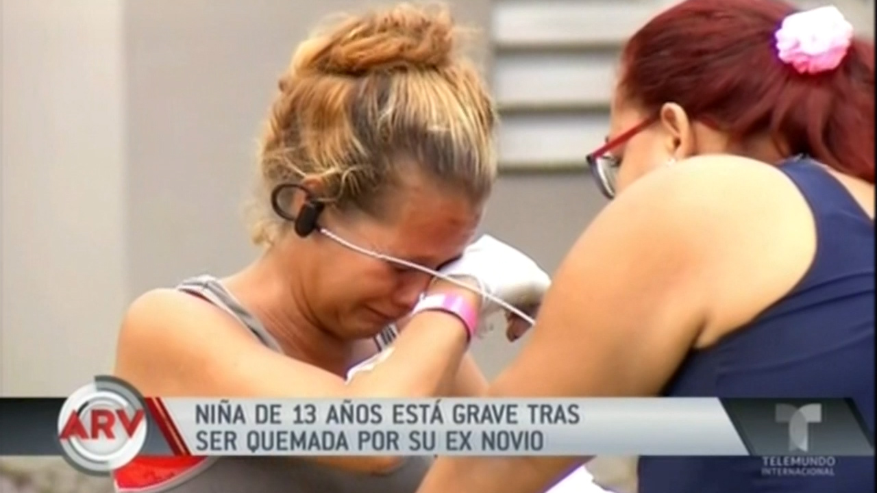 Niña De 13 Años Está Grave Tras Ser Quemada Por Su Ex Novio