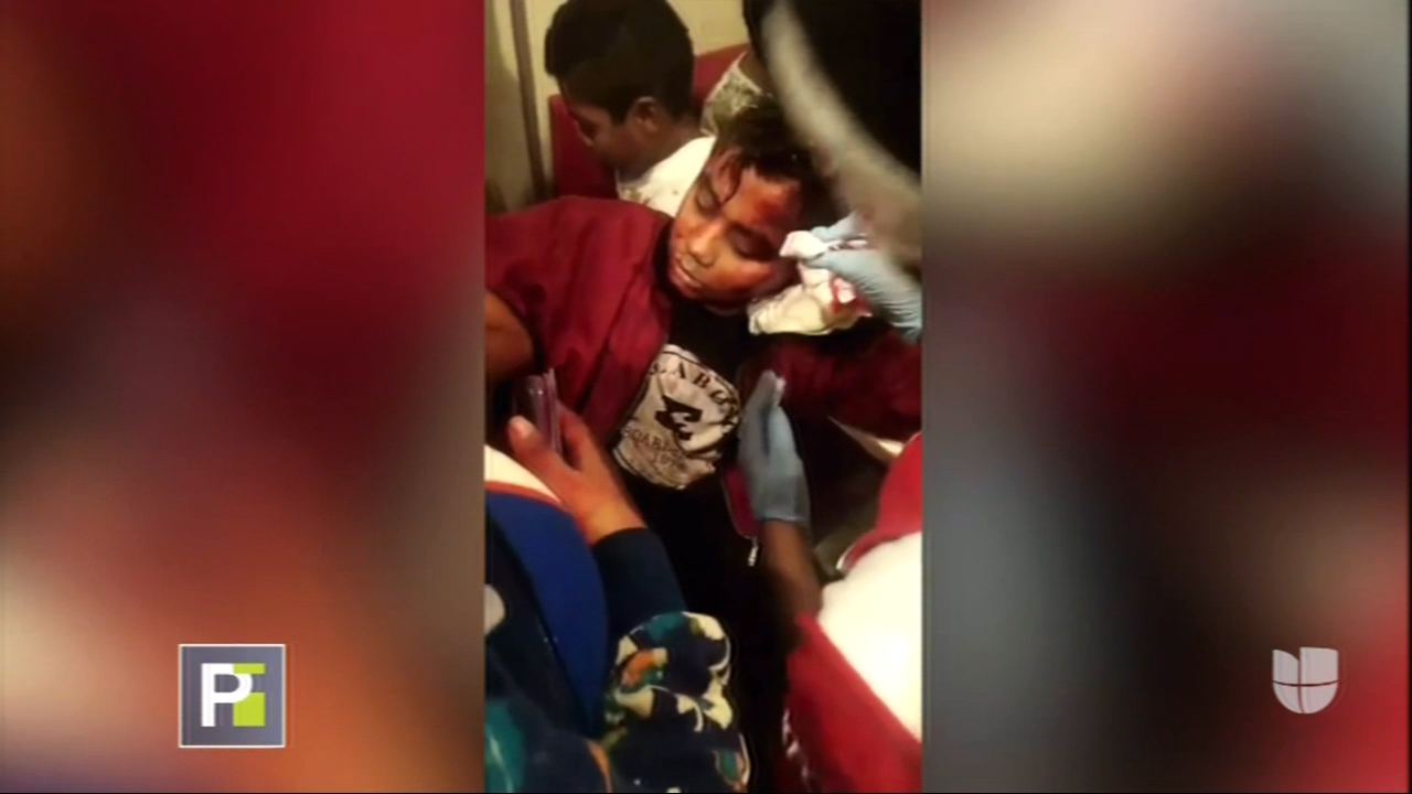 Golpean Salvajemente Niño De 11 Años Para Robarle Sus Tenis En Perú