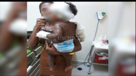 Mujer Y Su Bebé Sufren Quemaduras En Incendio Destruyo Tres Viviendas