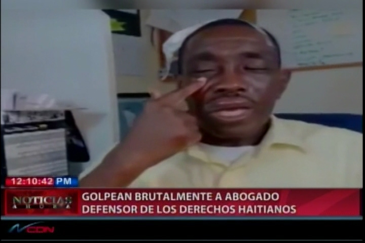 Golpéan Brutalmente A Abogado Defensor De Los Derechos Haitianos