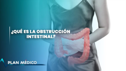 ¿Qué Es La Obstrucción Intestinal? | Plan Médico