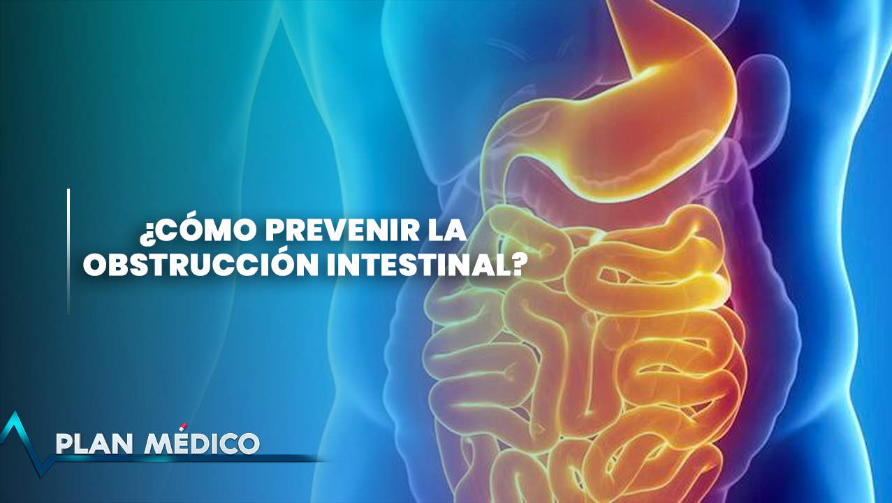 ¿Cómo Prevenir La Obstrucción Intestinal? | Plan Médico