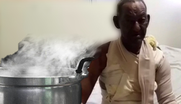 Mujer Le Echa Una “Paila” De Agua Caliente A Su Esposo Por Una Tarjeta Solidaridad