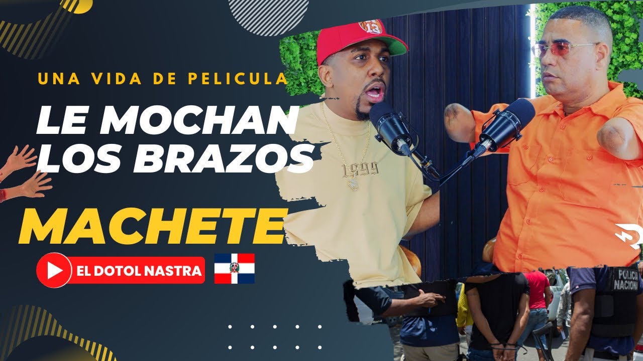 Perdió Sus 2 Brazos De La Manera Más Cruel Y Aun Así Es Feliz | El Dotol Nastra