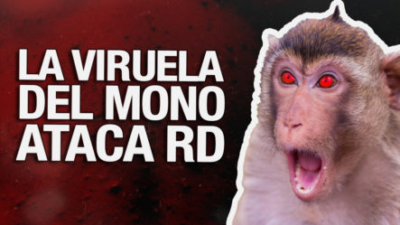 Aumentan Los Casos De La Viruela Del Mono En RD ¿Nueva Pandemia En Camino?