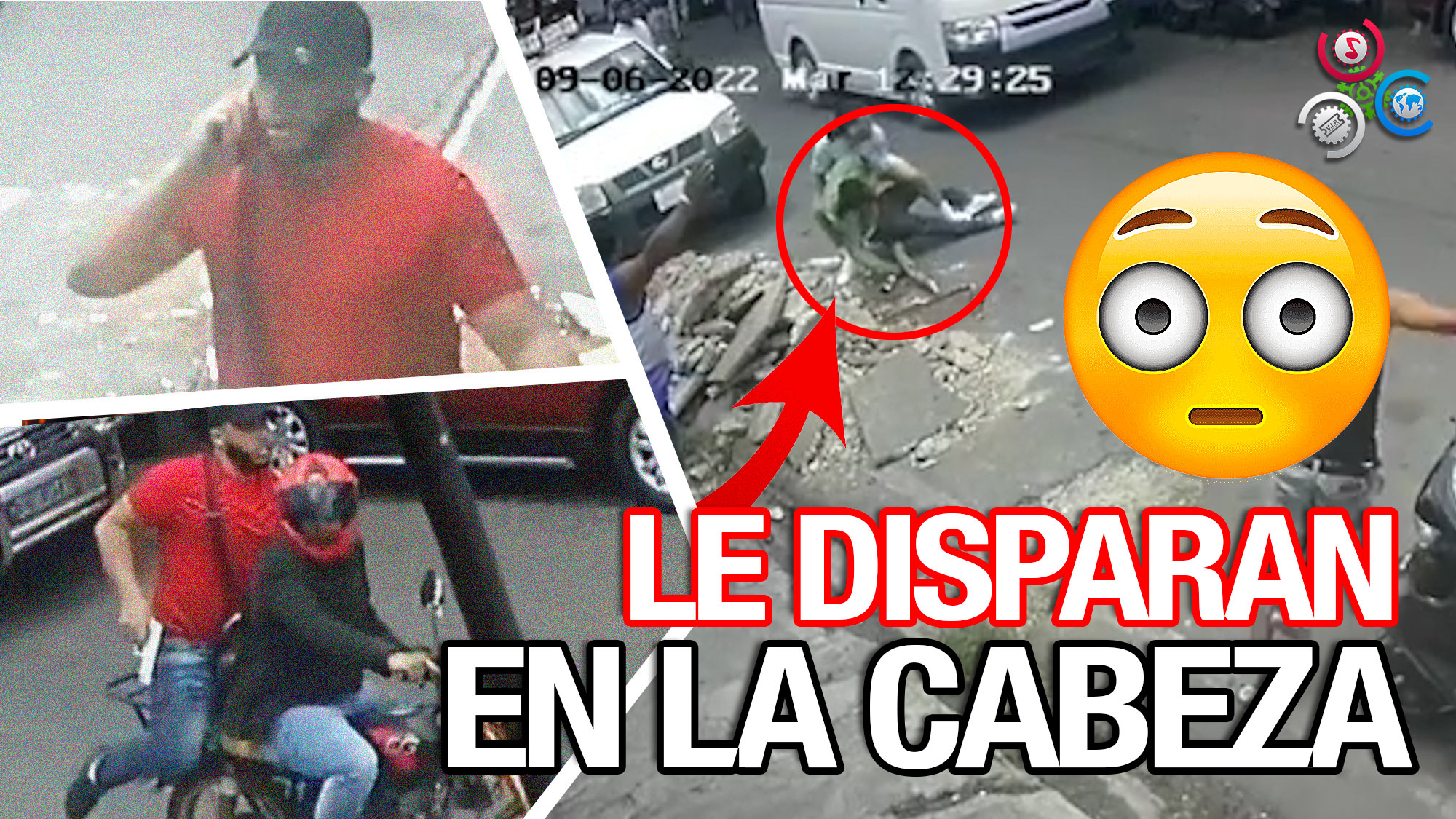 INCREÍBLE: Delincuentes Le dispararon En La Cabeza Y Emprenden Huida