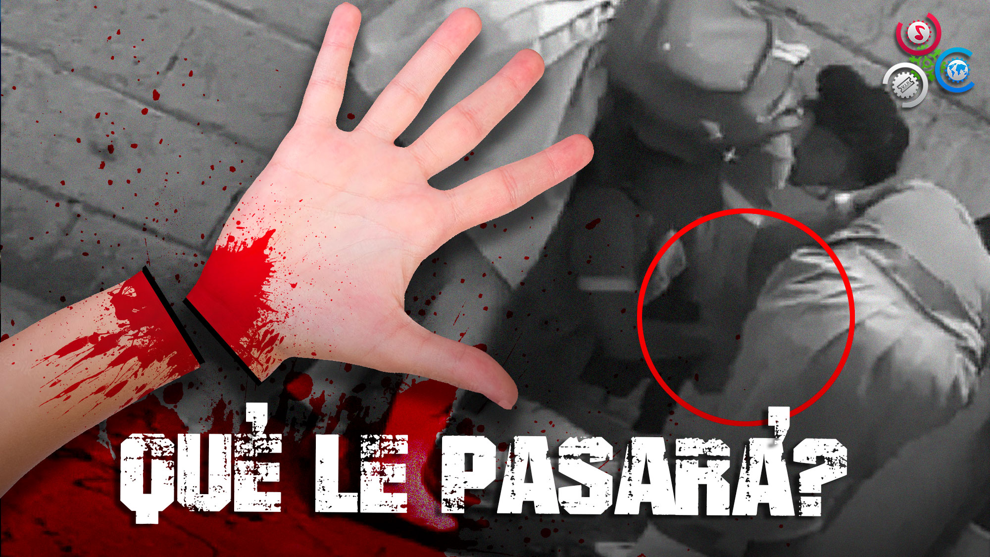 Doctor Revela El Estado Actual Del Menor Al Que Le Cercenaron La Mano 