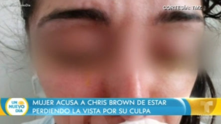Mujer Acusa A Chris Brown De Estar Perdiendo La Vista Por Su Culpa