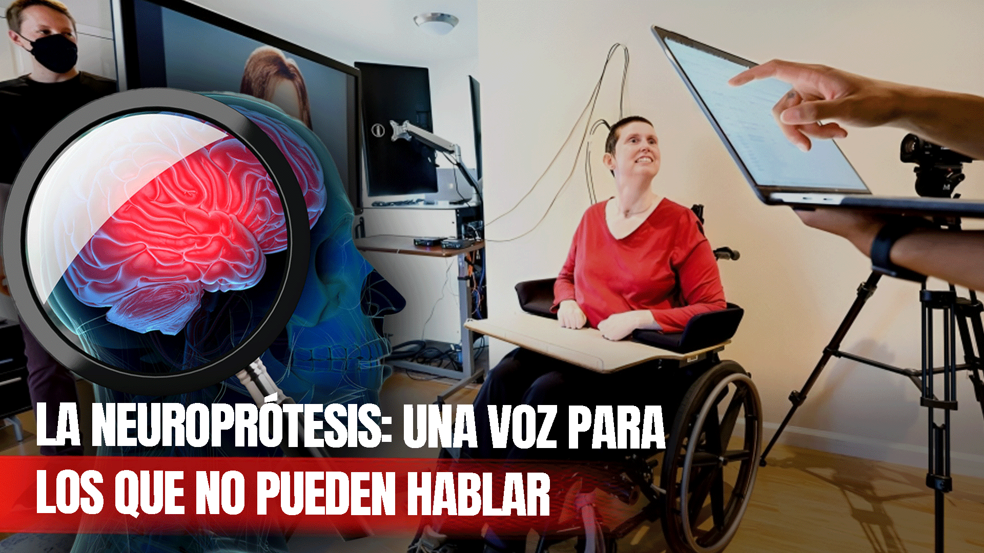 Una Neuroprótesis Se Convierte En Una Esperanza Para Quienes No Pueden Hablar