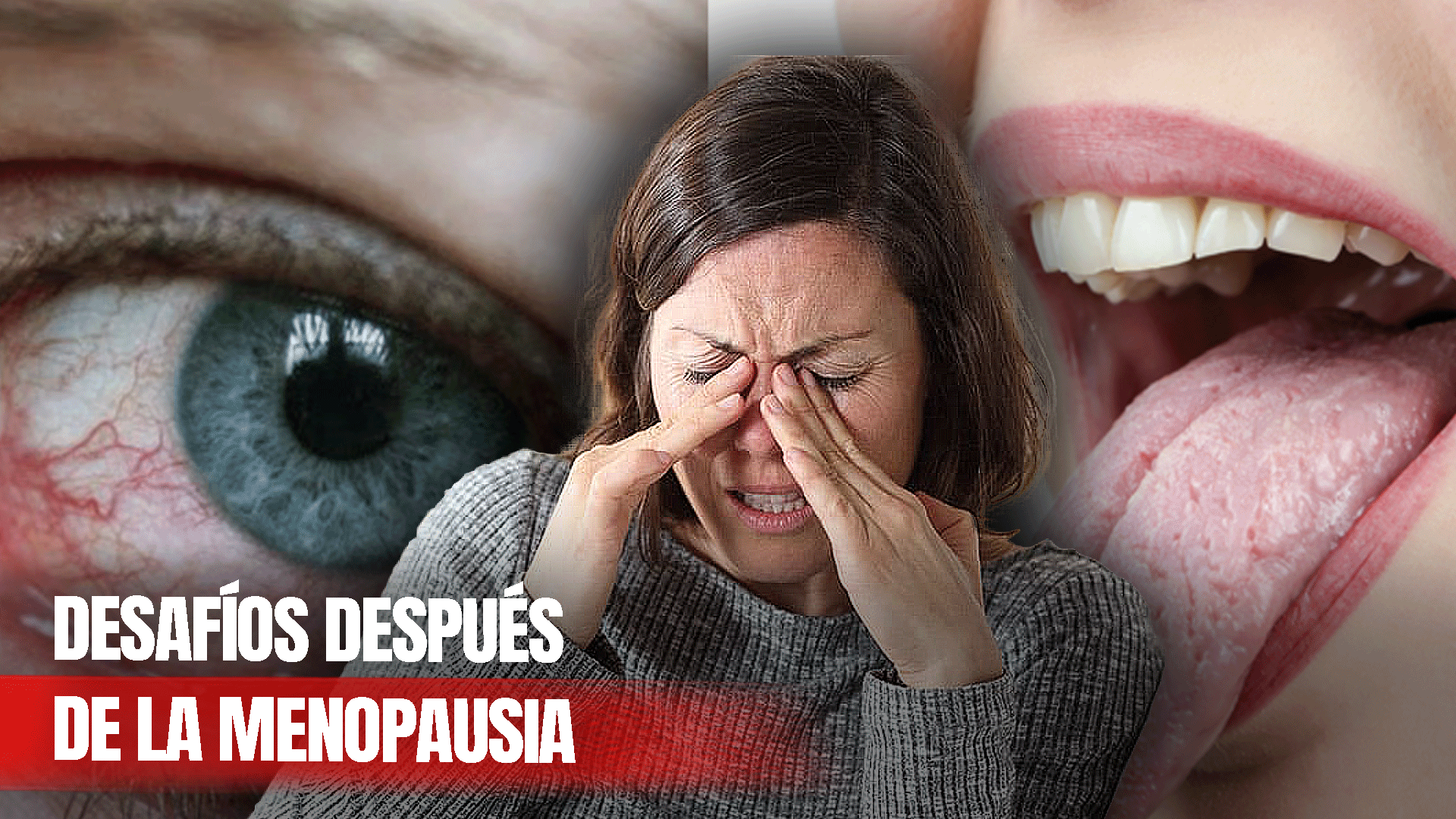 Síndrome De Sjögren, Un Trastorno Postmenopausia