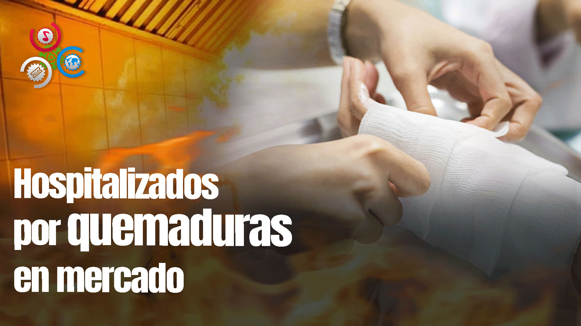 Permanecen Ingresadas Dos Personas Que Resultaron Con Quemaduras En Incidente Mercado El Almirante