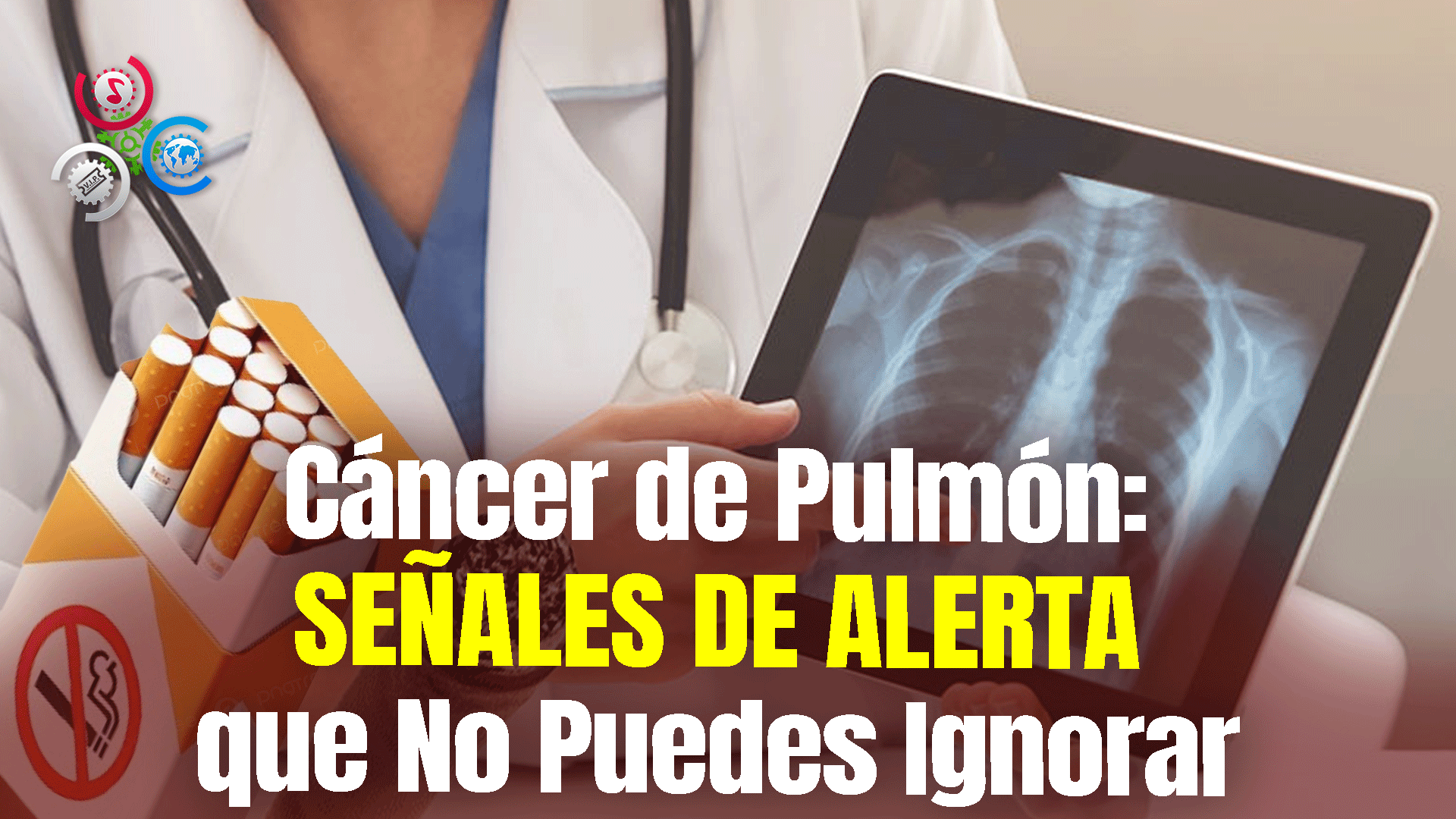 ¿Cuáles Son Los Síntomas Del Cáncer De Pulmón?