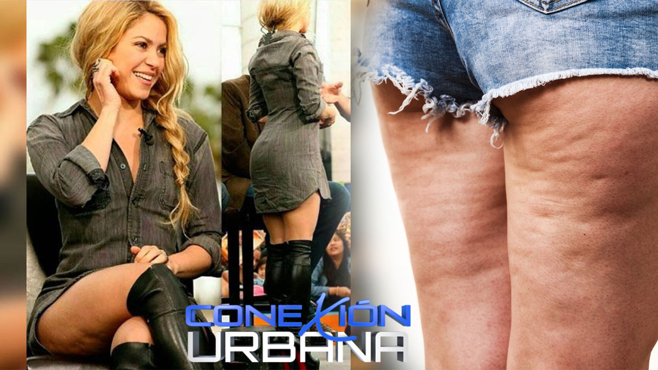 Shakira Y Sus Celulitis : Analisis Completo