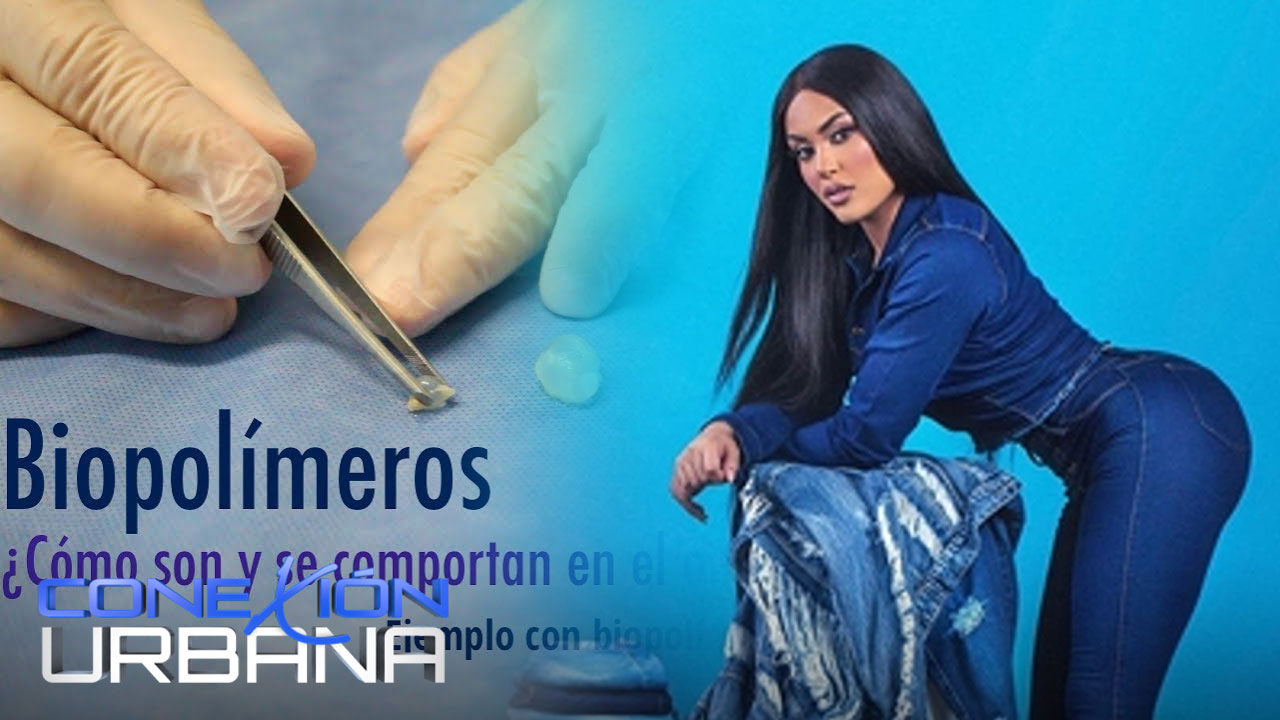 Cirujano Revela Los Reales Daños Que Sufrió Nabila Tapia Por El Biopolímeros