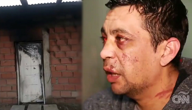 Vecinos Le Queman Su Casa Y Dan Tremenda Golpiza A Enfermero Por Dar Positivo De Covid-19