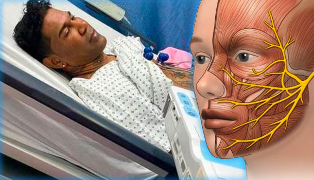 La Posible Causa De La Parálisis Facial Que Le Ocurrió A Omega El Fuerte