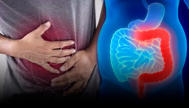 Las Causas De La Colitis O La Inflamación En El Colón Con El Dr. Santiago Núñez