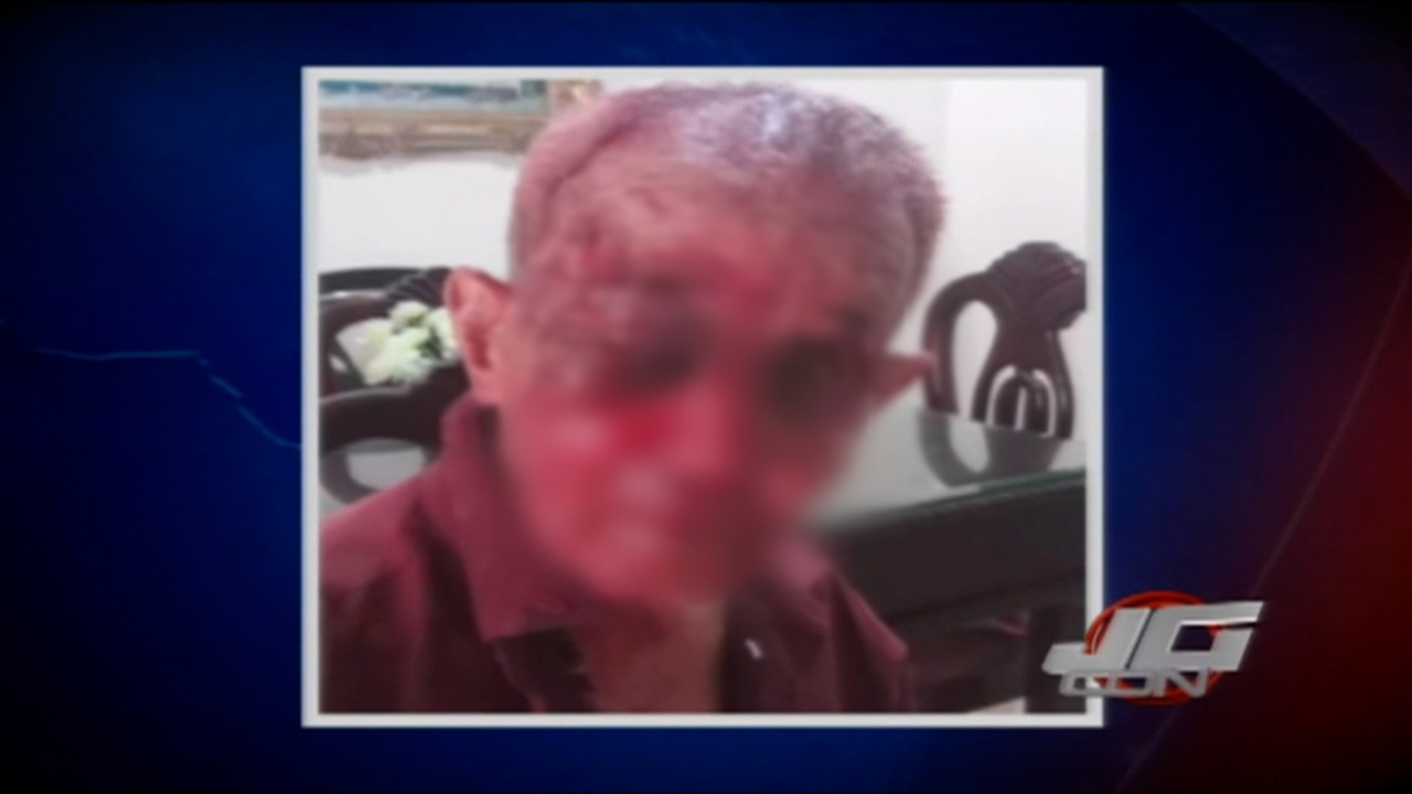 Hermano Le Propina Tremenda Golpiza A Señor De 85 Años Con Alzheimer