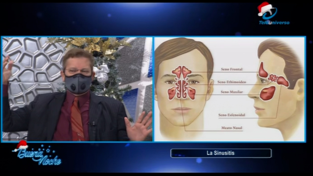 El Dr. Santiago Núñez Explica Las Causas De La Sinusitis Y Por Qué Provoca Dolor De Cabeza En Buena Noche