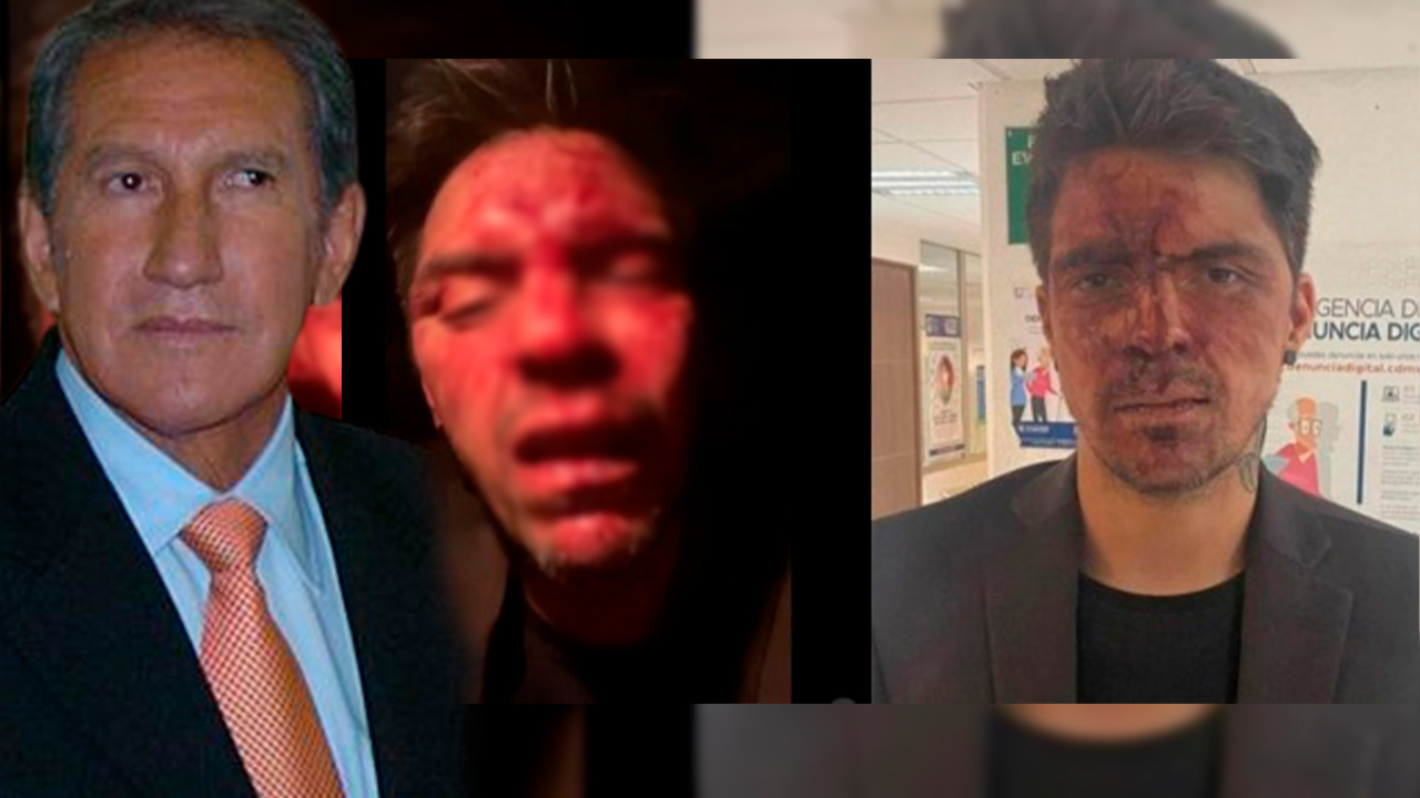 Hijo De Lupita D’alessio Es Brutalmente Golpeado Y Culpan Gobernador Mexicano Arturo Montiel