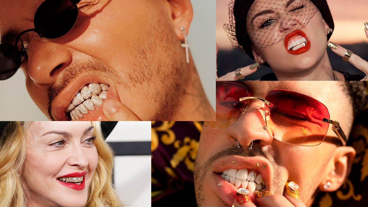 Dientes De Oro Podrían Dejar Sin Dientes Reales A Los Artistas