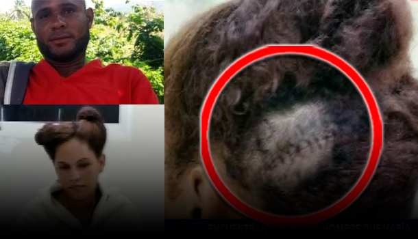 Encuentran Ahorcado Al Hombre Que Hirió De Varios Machetazos A Su Ex Pareja En Nagua