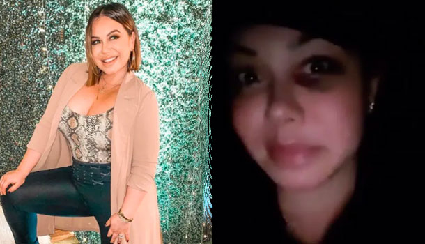 Habla La Cantante Chiquis Rivera Tras Aparecer Con Un Ojo Morado