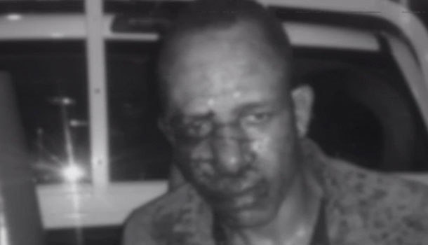 Un Hombre Mató A Su Ex Pareja La Madrugada De Este Lunes En SJM