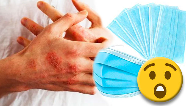 Dermatóloga Especialista Habla Sobre Los Problemas En La Piel Por El Uso De Mascarillas Contra El Covid-19