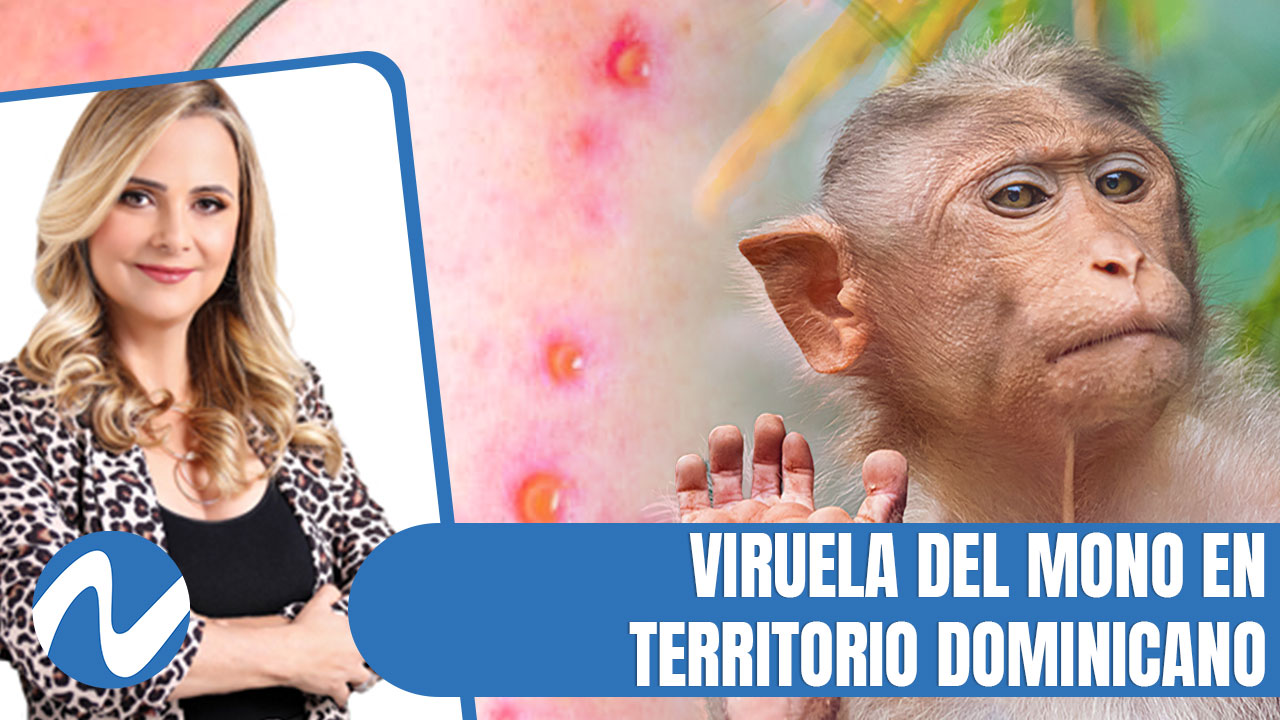 Viruela Del Mono En Territorio Dominicano