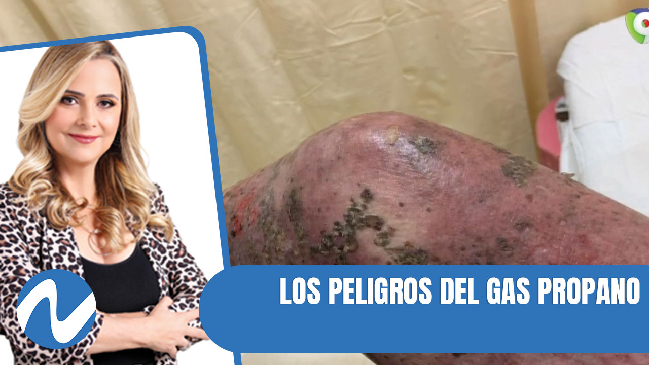 Los Peligros Del Gas Propano