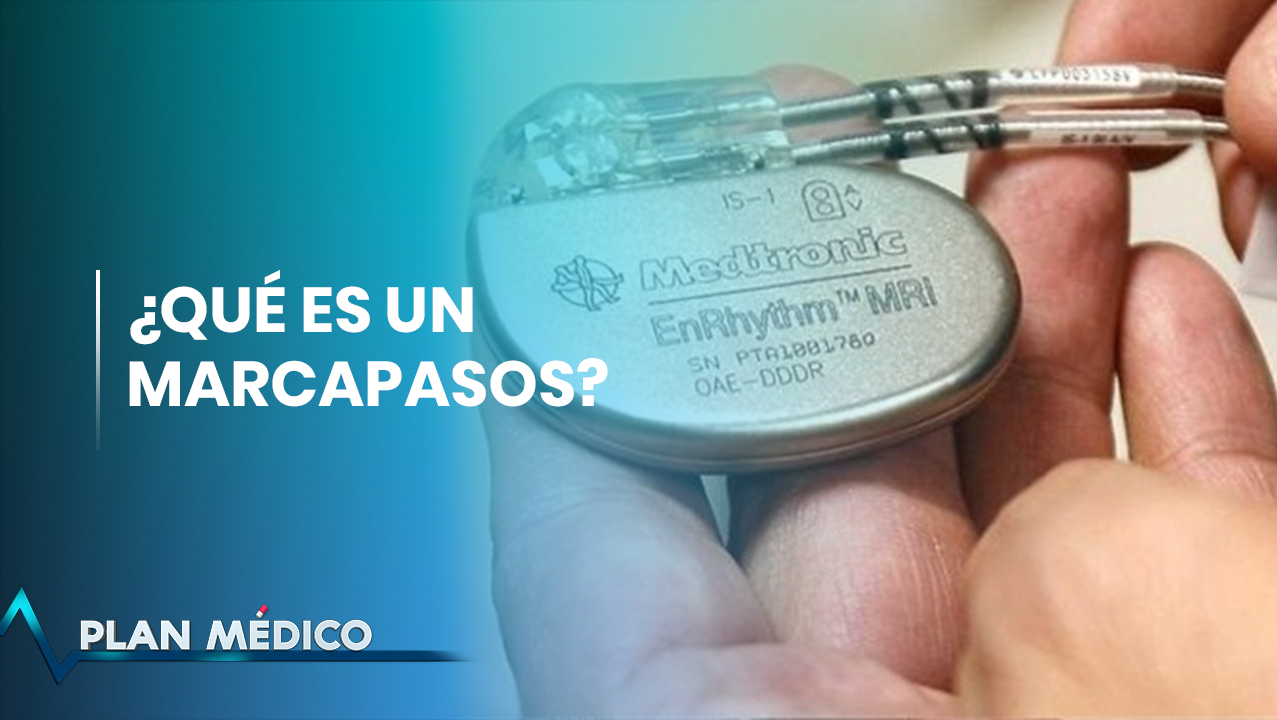 Marcapasos: Equipo Que Salva Vidas | Plan Médico (1/2)