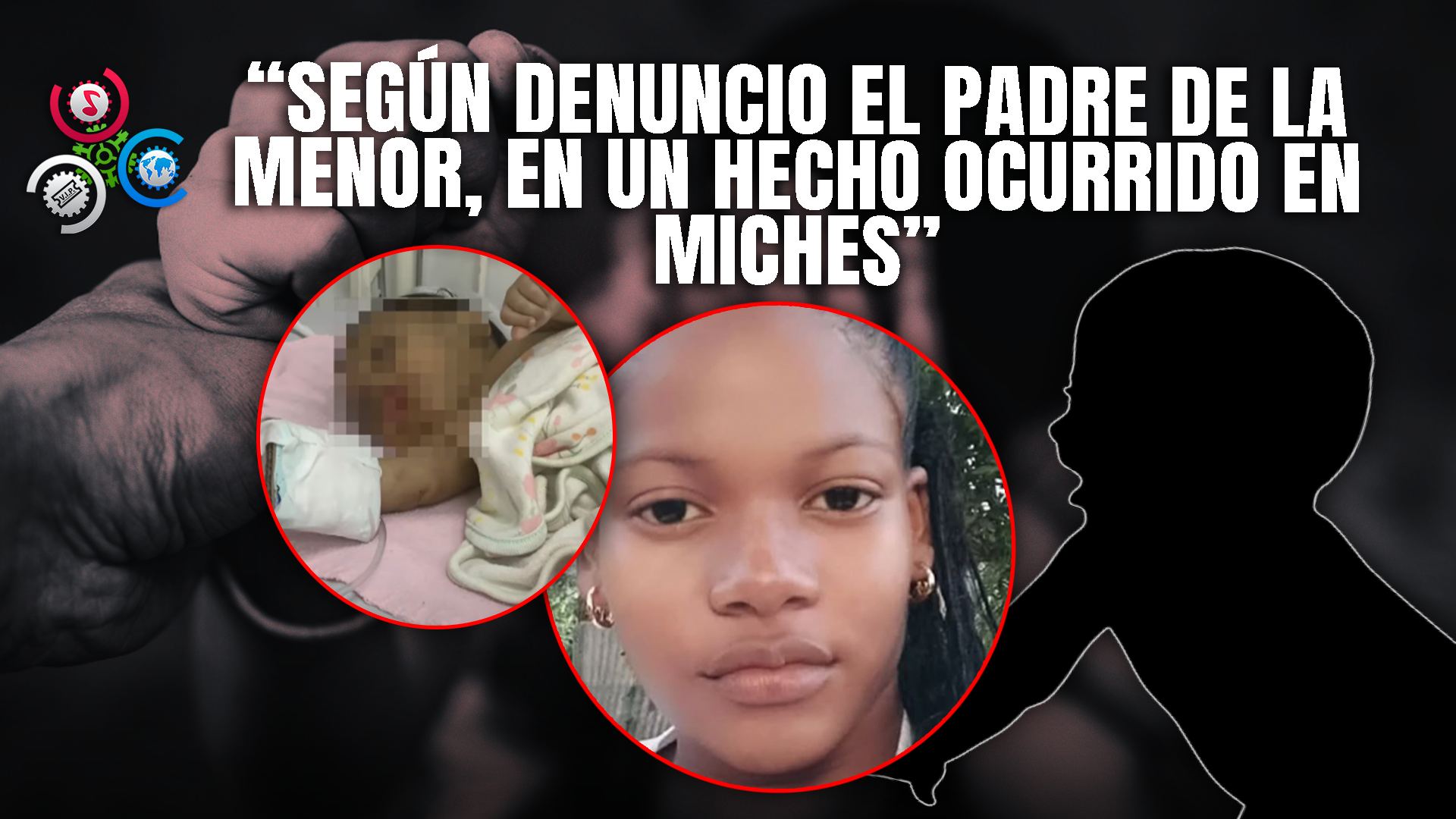 Recién Nacida Con Fracturas En Miches: Señalan A La Madre Como Presunta Agresora