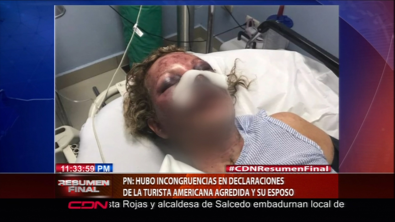 PN:Hubo Incongruencias En Declaraciones De La Turista Americana Agredida Y Su Esposo