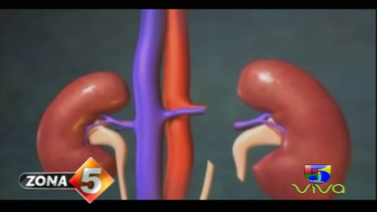 Prueba De Amor Muestra Muestra Elizabeth Al Donar Un Riñón A Su Hermana  