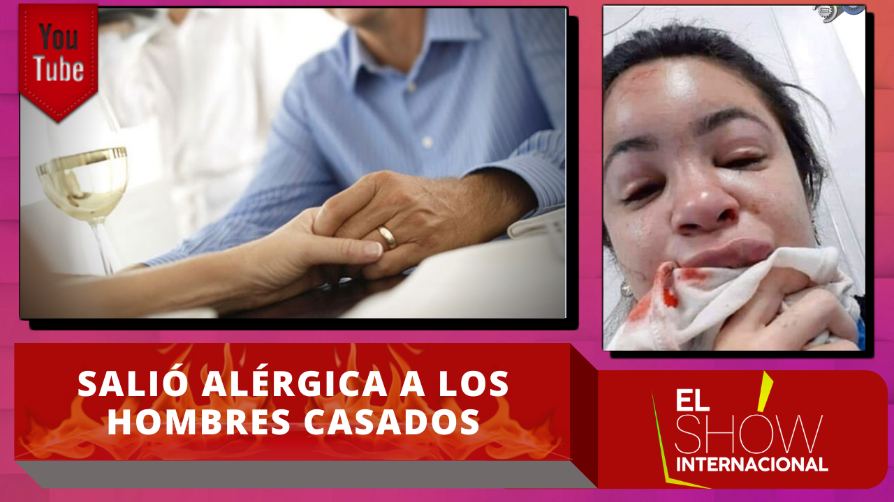 Esta Mujer Se Dio Cuenta Que Es Alérgica A Los Hombres Casados