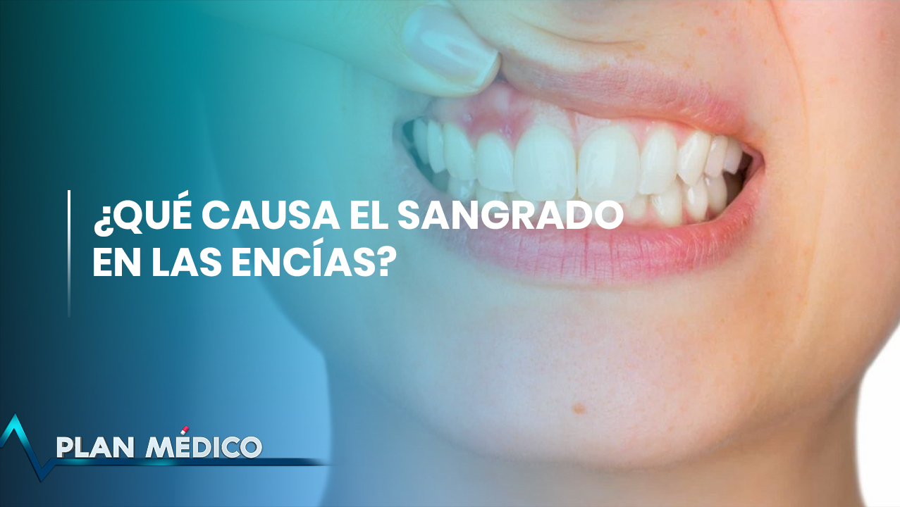 ¿Por Qué Sangran Las Encías? | Plan Médico 1/2