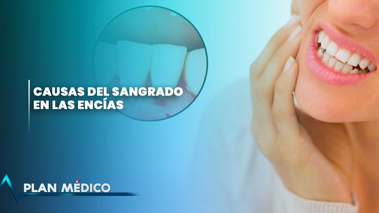 Causas Del Sangrado En Las Encías | Plan Médico