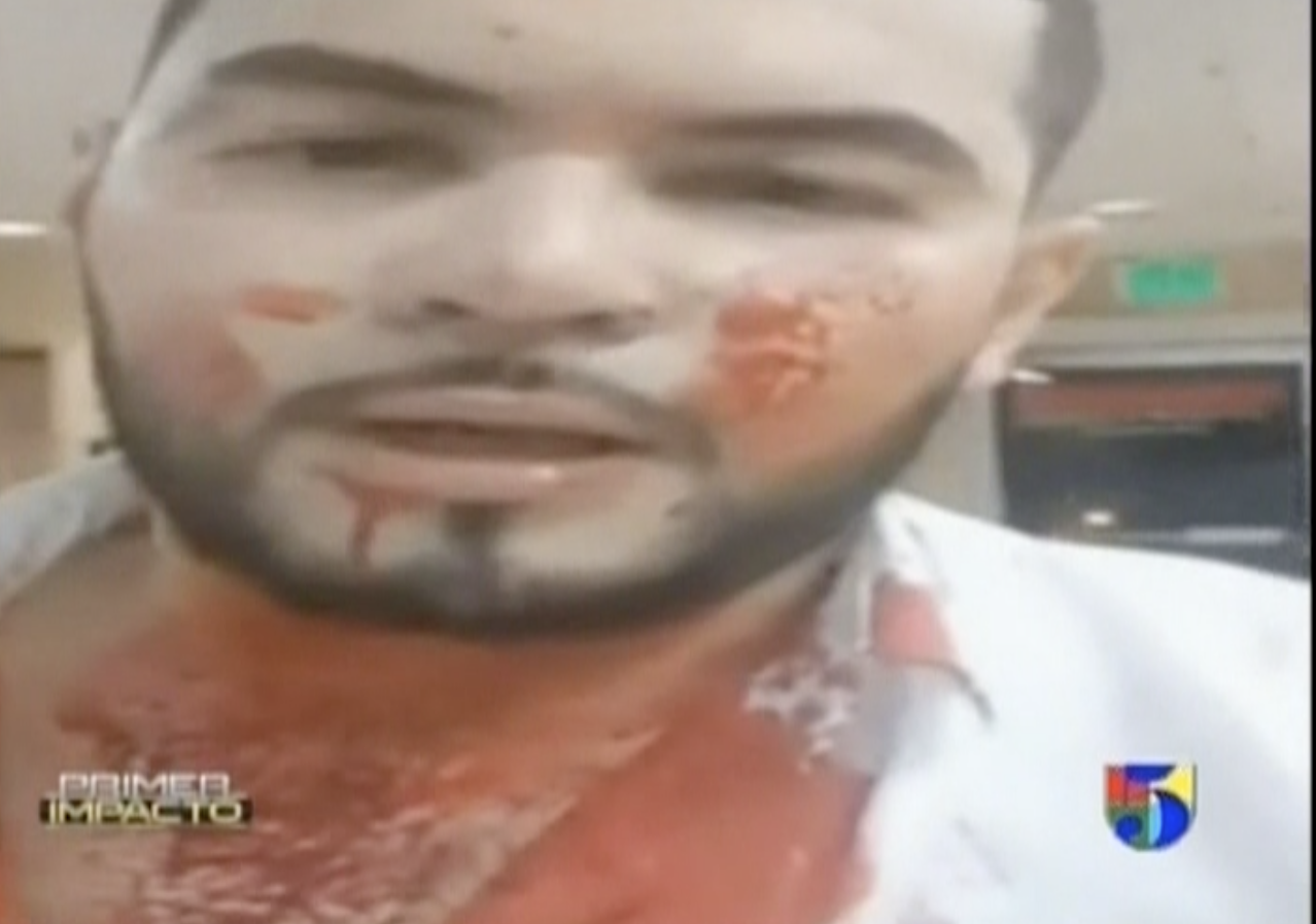 Cantante Eduardo Ochoa Sobrevive A Balacera En Sonora