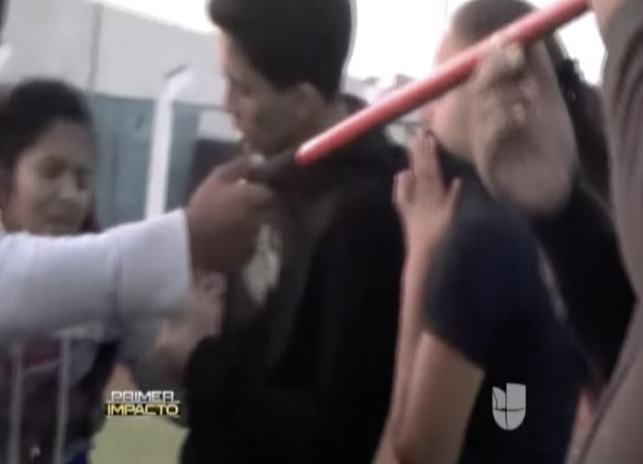 Adolescente Sufre Grave Accidente Con Jabalina