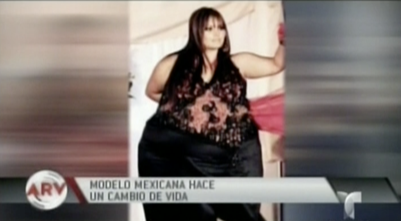 Increíble Cambio De Una Modelo Mexicana Que Superó La Obesidad