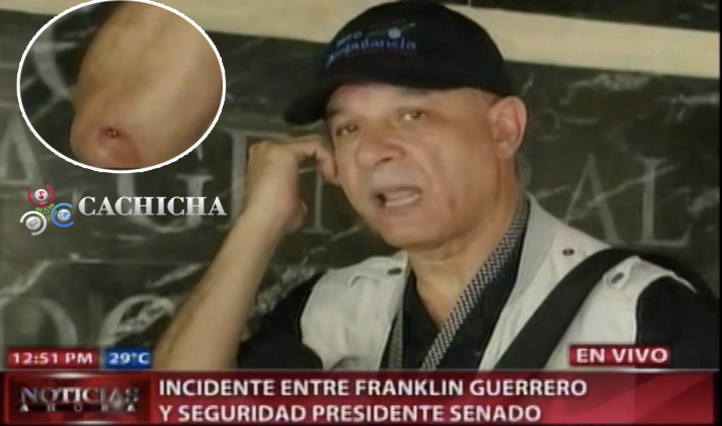 Seguridad De Reinaldo Pared Agrede Al Periodista Franklin Guerrero